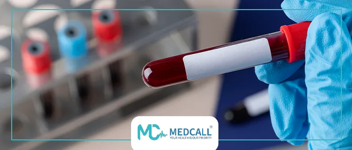 تحليل الكرياتينين في الدم