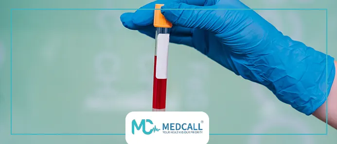 تحليل فقر الدم في المنزل